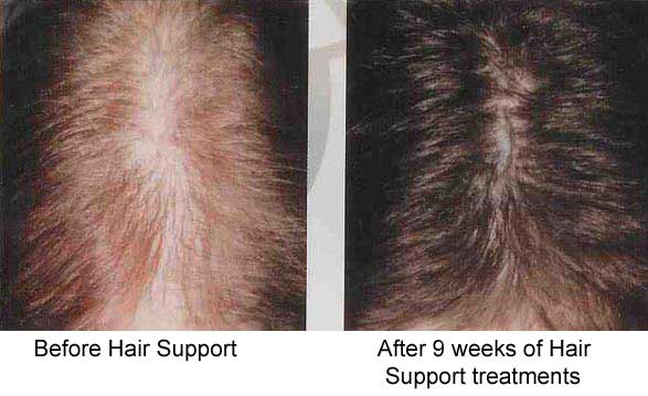 Hair Support Before & After